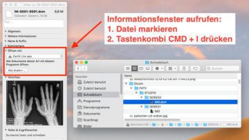 osirix lite image viewer for windows 10 osirix lite image viewer for windows 10