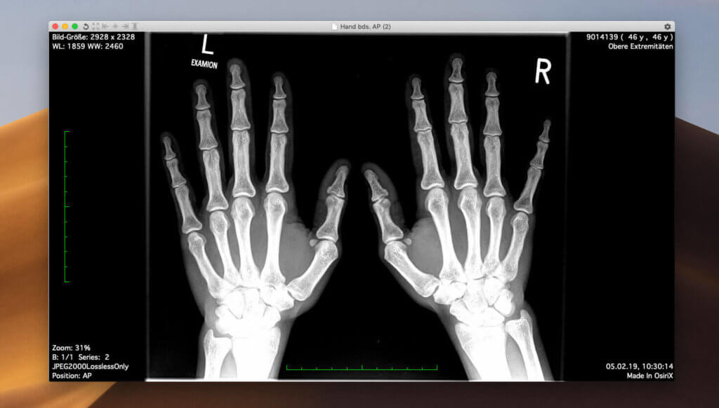 osirix lite mac osirix lite mac