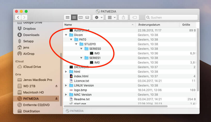 dcm file viewer for mac dcm file viewer for mac